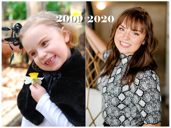 Lillie Before After